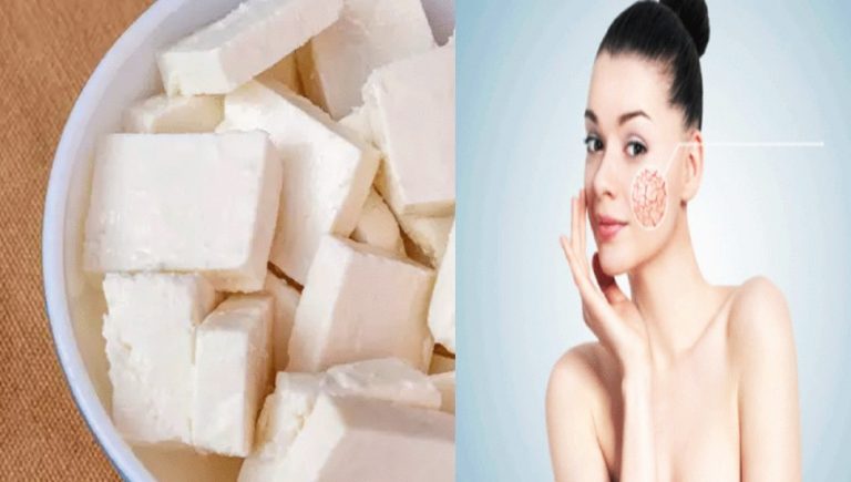 Skin Care Benefits Of Paneer, Know the right way to eat it