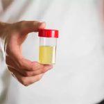 Change in the color of urine, it can be a sign of this serious disease!