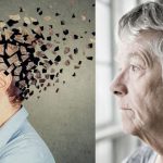 Alzheimer's disease