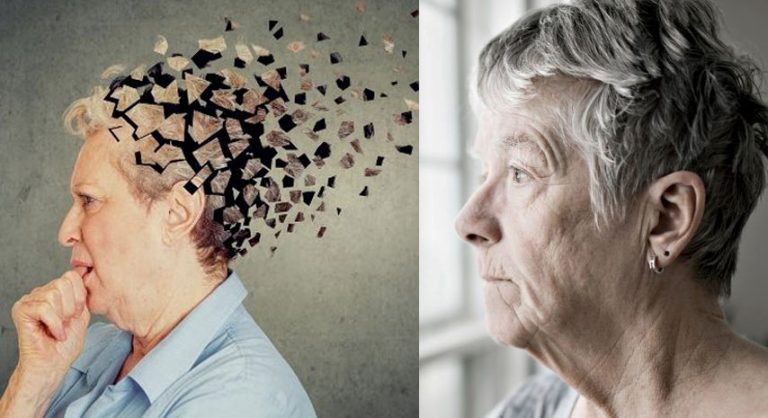 Do not ignore Alzheimer’s disease, know its symptoms and methods of prevention