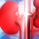 Kidney Disorders: Causes, Symptoms, and Treatment