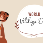 World Vitiligo Day 2023: Celebrating Diversity