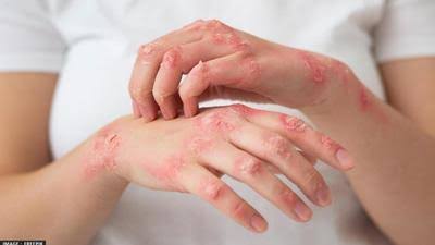 Itching in Hand Reasons: Do not ignore itching in hands, these 5 serious diseases can be the reason