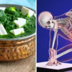 Diet for Strong Bones: Expert Opinion from Dr.