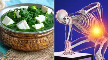 Diet for Strong Bones: Expert Opinion from Dr.